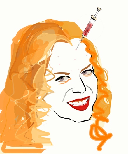 Nicole Kidman Botox